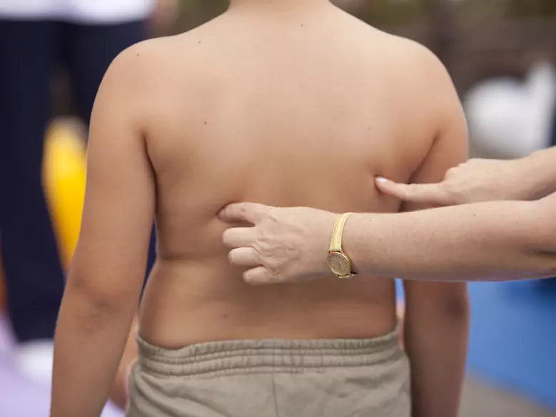 Atherosclerosis and heart attack in children - is it possible?