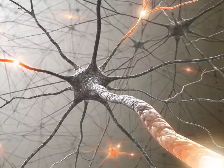 Trigeminal nerve palsy