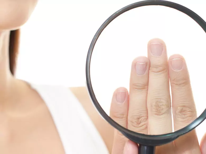 What are the most effective remedies for nail fungus?