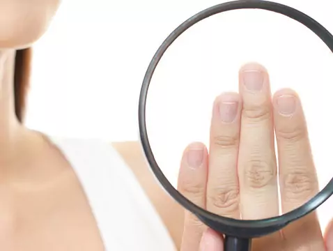 What are the most effective remedies for nail fungus?