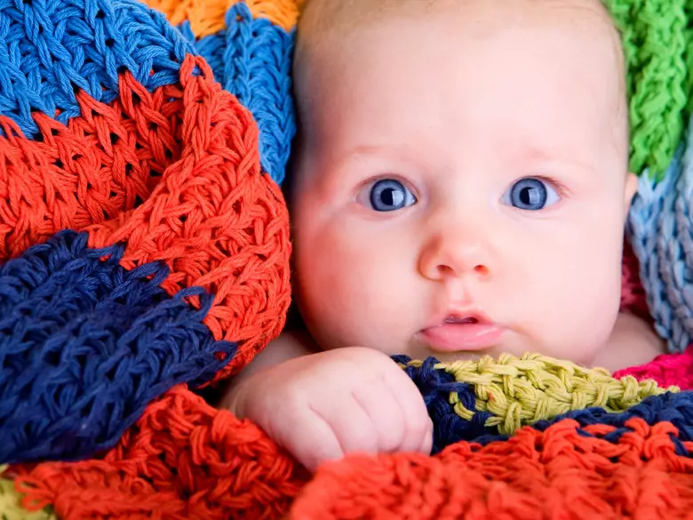 Excessive head circumference growth in an infant