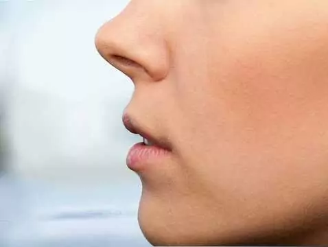 Sinusitis - causes, symptoms, diagnosis, treatment