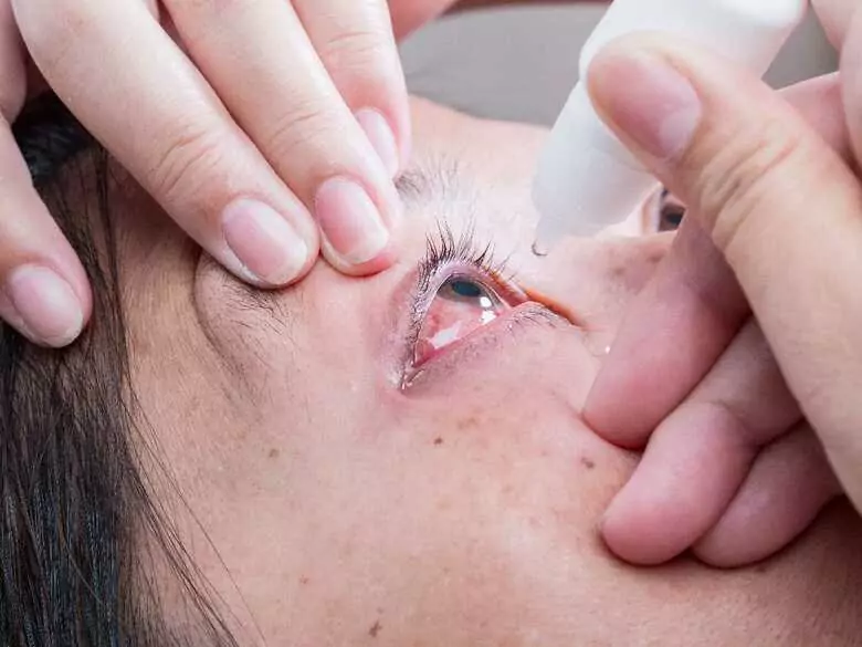 Long-term redness of the eye and its effects