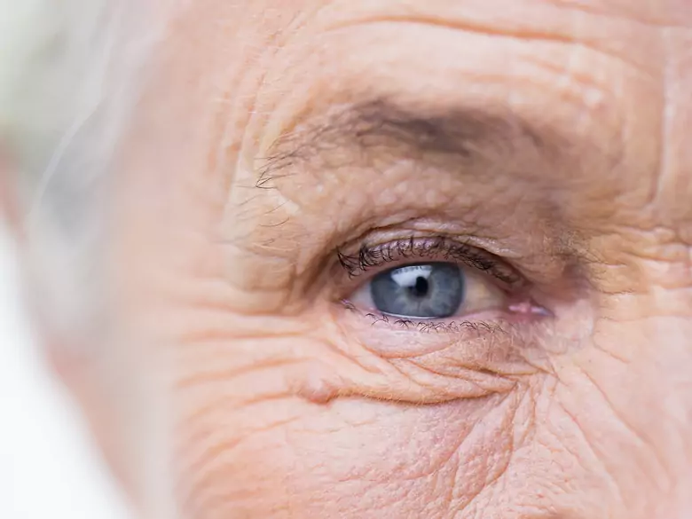 Dermatological aspects of the menopause - the impact of hormones