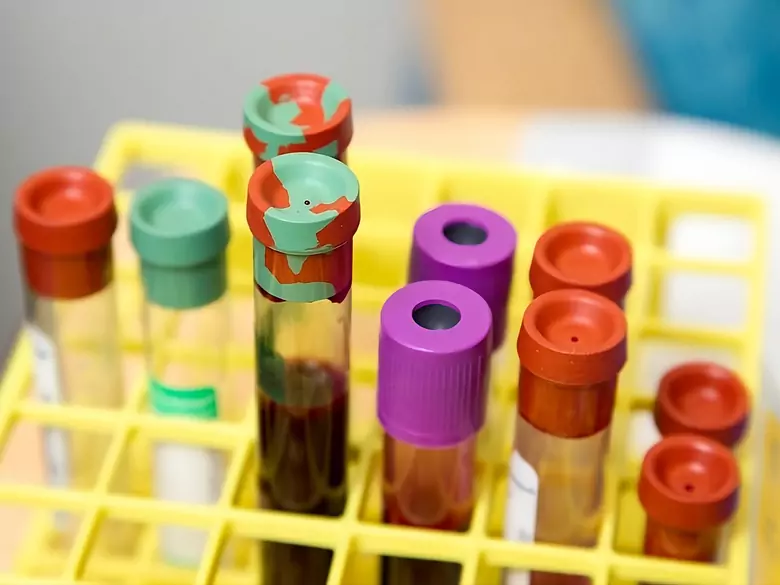 Oncopackage - why is micronutrient testing so important for cancer detection?