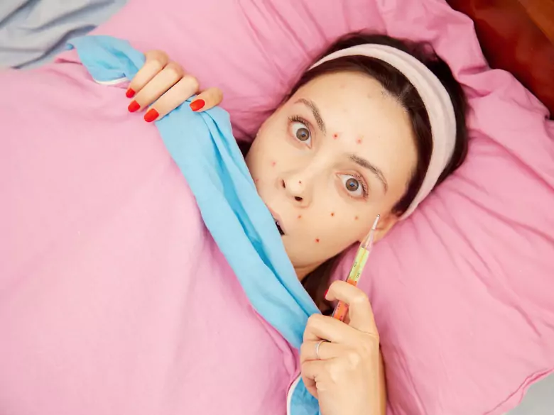 Symptoms and consequences of chickenpox in adulthood