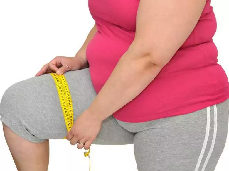 Bariatric surgery, or surgery to treat obesity