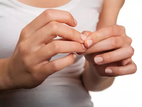 Nail fungus - how to treat it?