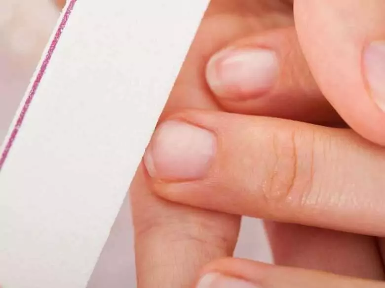 Nail plate changes and ringworm 