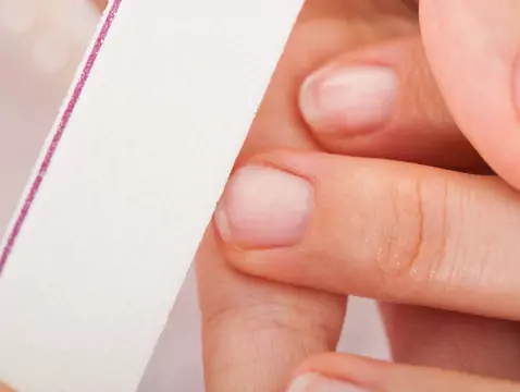 Nail plate changes and ringworm