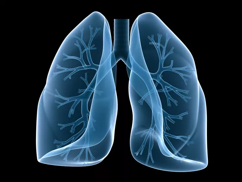 Pulmonary hypertension - a serious cardiovascular disease