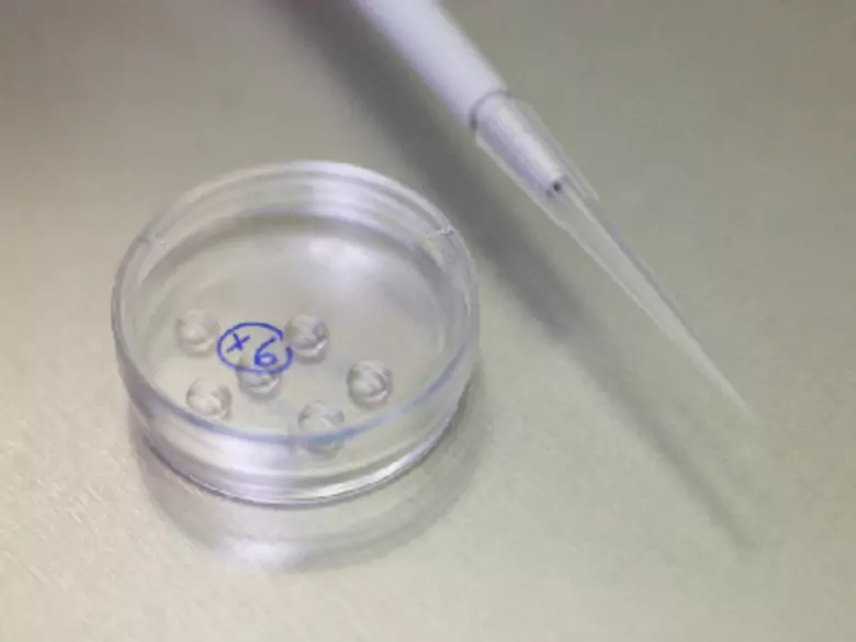 Haemophilus influenzae in a throat or nasal swab - causes, symptoms, diagnosis, treatment