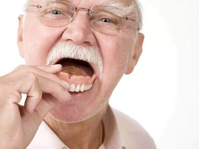 Types of dentures