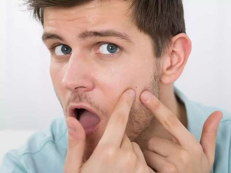 Acne and vitamin D - find out the connection!