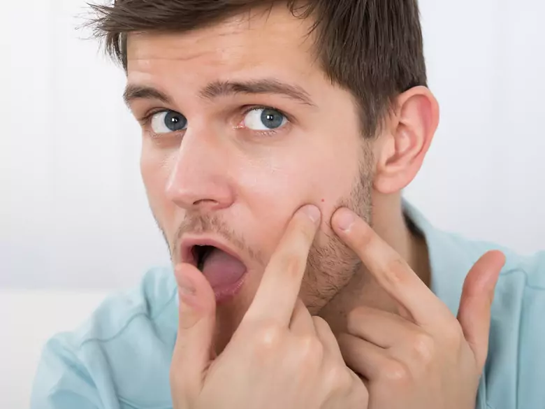 Acne and vitamin D - find out the connection!