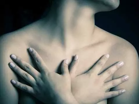 What does a subcutaneous breast amputation look like?