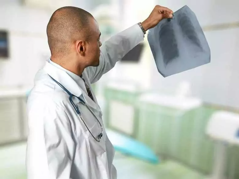 Inoperable lung cancer: when is surgery not possible and what treatment can then be used?