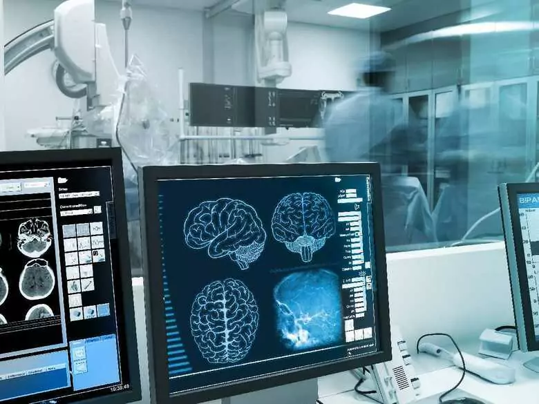 Epilepsy - a compendium of knowledge about epilepsy