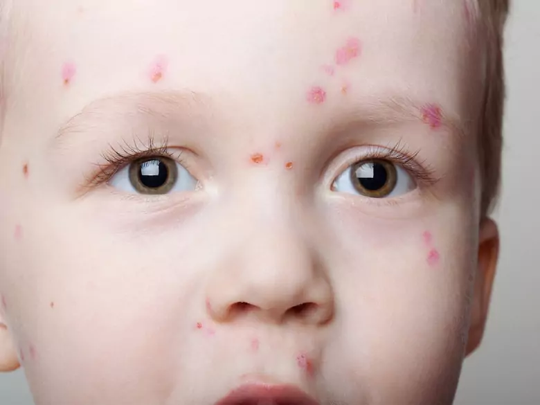 Can soap be allergenic?