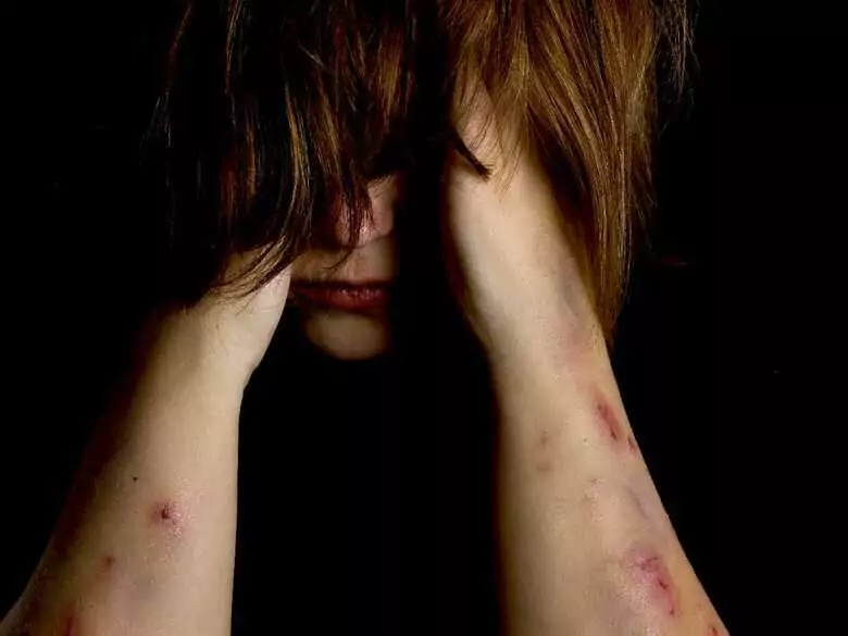 Self-harm in children: for what reasons do children self-harm?