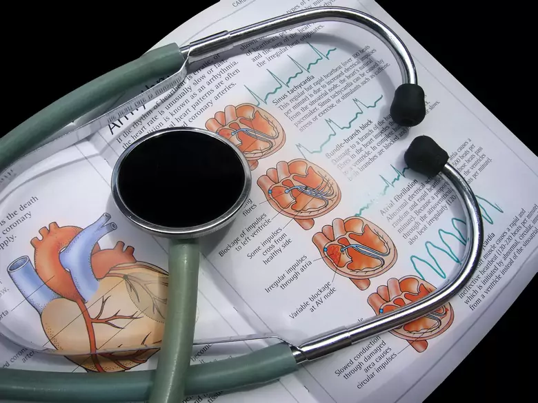 The most common heart diseases and their treatments