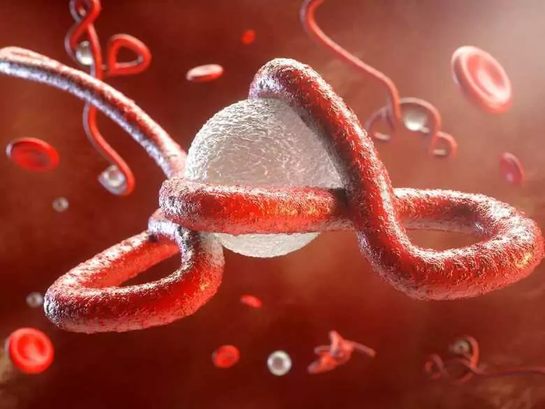 Pancytopenia, thrombocytopenia and leukopenia - what are they and how to treat them?