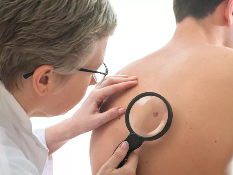 European Melanoma Day