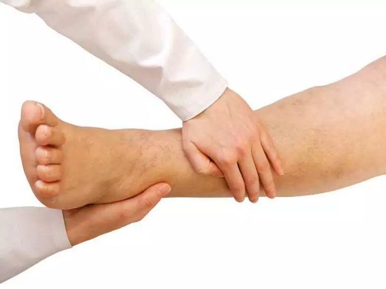 How to deal with lower limb insufficiency problems?