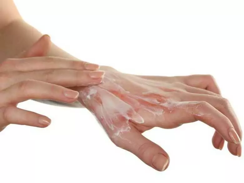 EB - blistering epidermal separation