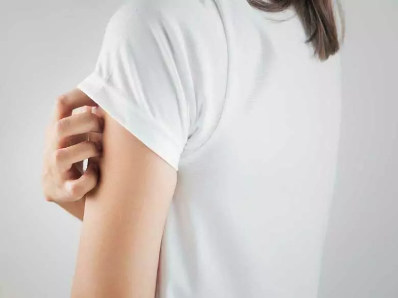 What is a contact allergy?