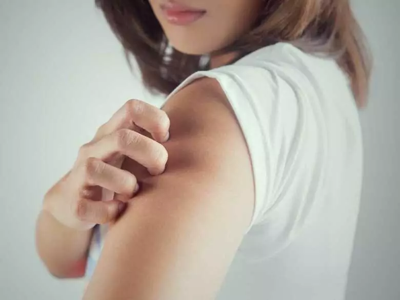 Allergic reactions after COVID-19 mRNA vaccine