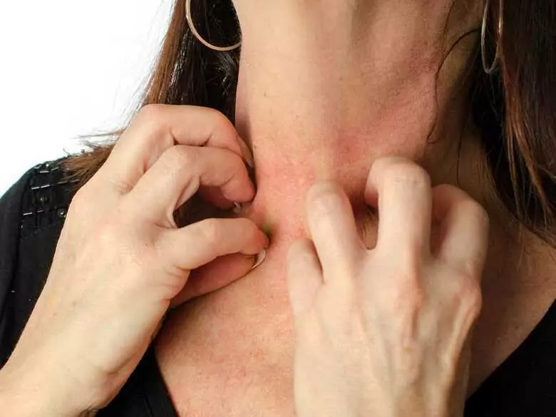 Why does the skin itch?