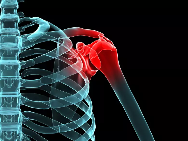 How to deal with musculoskeletal problems?