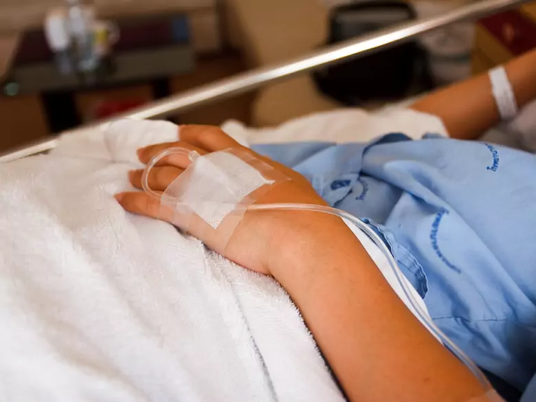 Coma - causes, symptoms, diagnosis, treatment