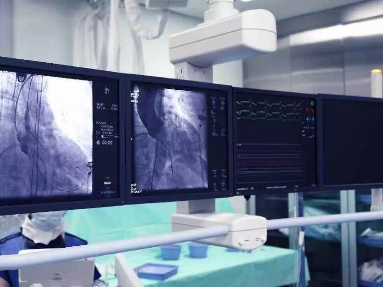 What are the benefits of coronary revascularisation?