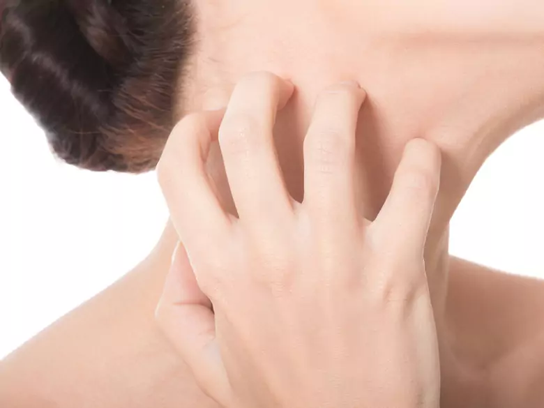 Atopic dermatitis: how to deal with it?