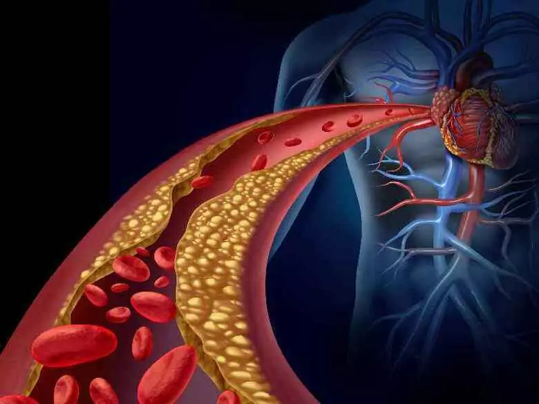 What are hemangiomas?