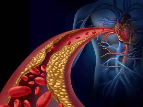What are hemangiomas?