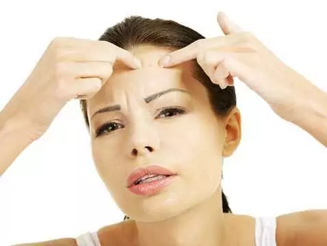 Acne after 30: what do you need to know?