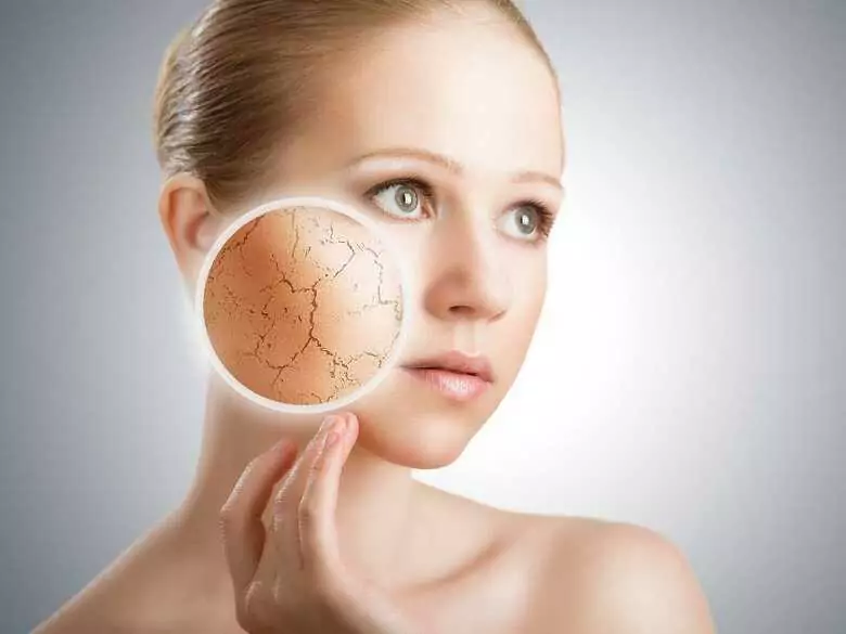 Does psychological state influence dermatological conditions?
