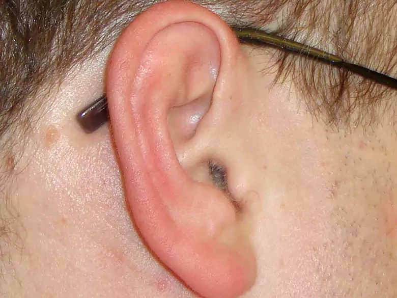 Disorders of ventilation and outflow from the middle ear - causes, symptoms, diagnosis, treatment 