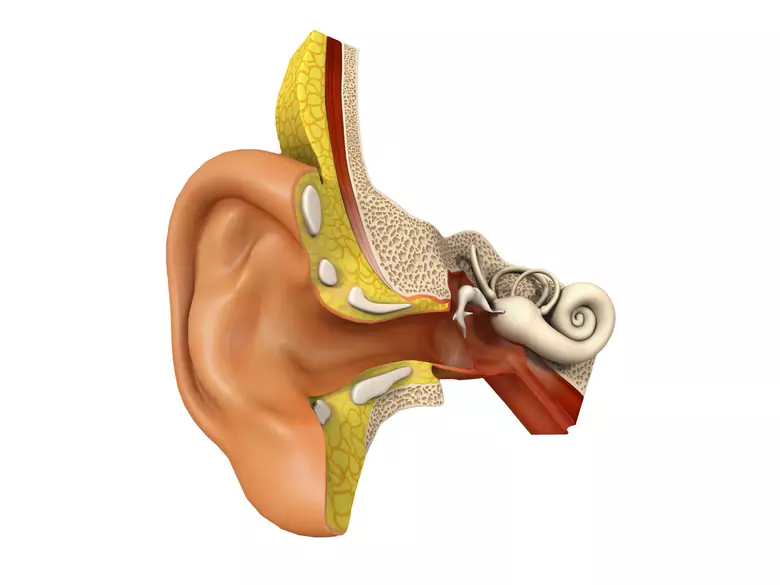 Iron deficiency and associated anaemia can lead to... hearing impairment?