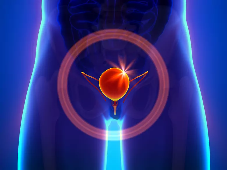 What is a healthy diet for people with urinary tract problems?