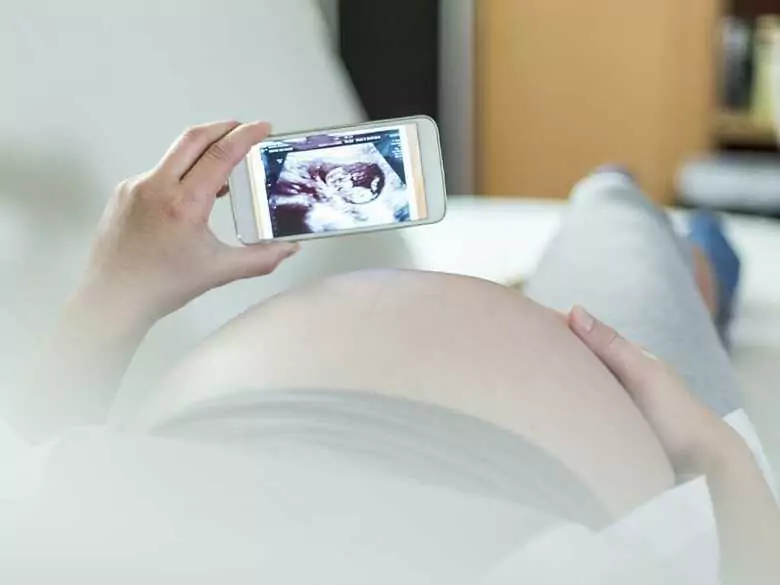 The baby in the womb