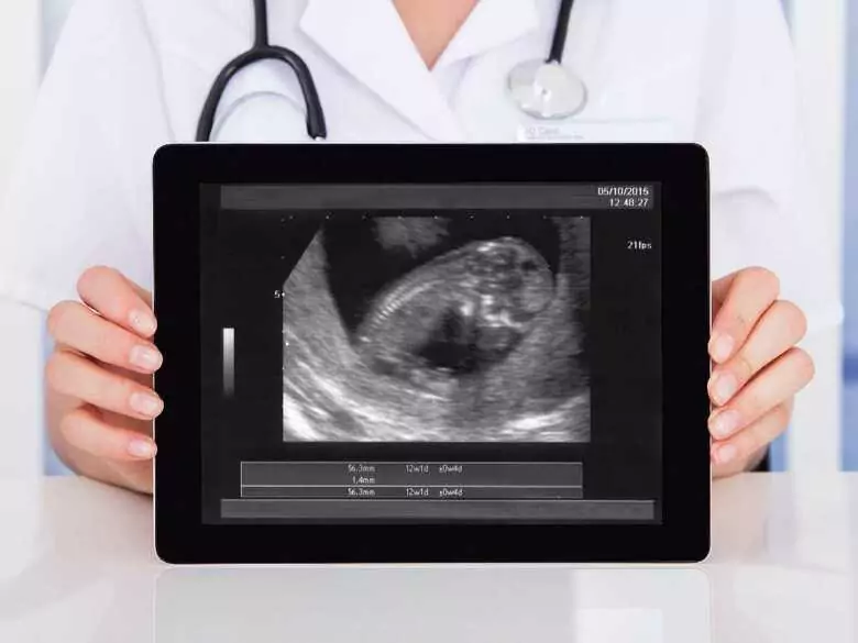 Ectopic pregnancy - what is it and what are its causes?