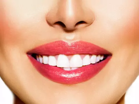 Teeth whitening by lamp