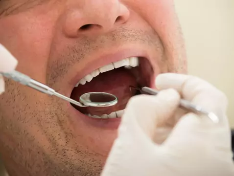 Drillless tooth treatment
