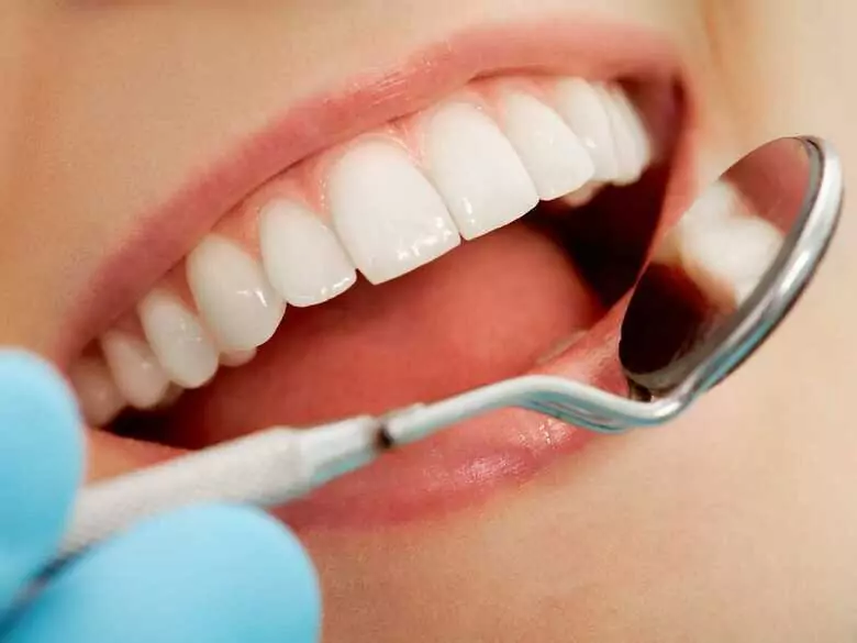 What causes teeth to turn black?