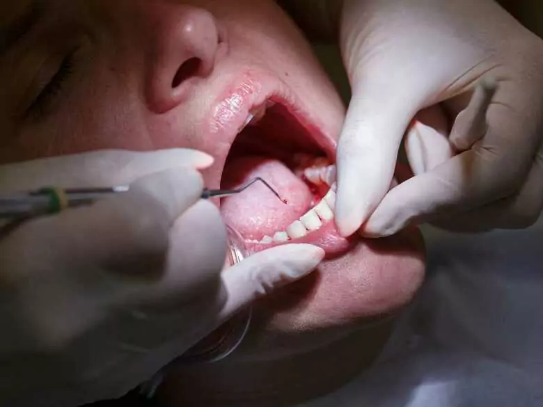 Will a vaccine win against periodontal disease?