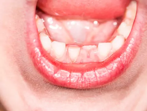 Cysts - everything we know about them and how to remove them surgically